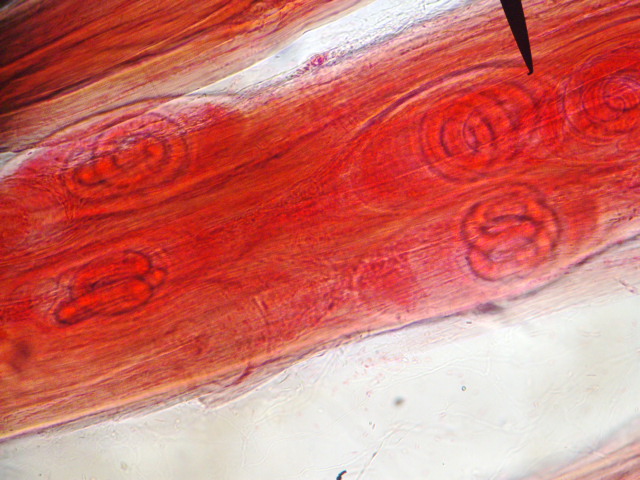 Trichinella spiralis larvae within muscle poljoprivredna apoteka Ras